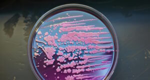 https://www.vecteezy.com/photo/55359190-pink-bacteria-growing-on-agar-plate-in-microbiology-lab