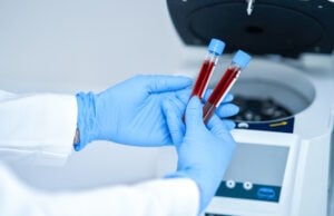 https://www.vecteezy.com/photo/15895000-test-tube-with-blood-and-mixing-machine