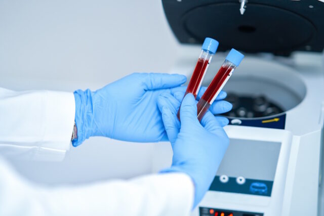 https://www.vecteezy.com/photo/15895000-test-tube-with-blood-and-mixing-machine