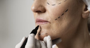 https://www.freepik.com/free-photo/woman-with-marker-traces-face-close-up_25106419.htm#fromView=search&page=1&position=35&uuid=dfa32892-827a-4c60-a5d6-8028b634c034&query=facial+makeover