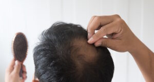 https://www.freepik.com/premium-photo/men-are-worried-about-hair-loss_2943650.htm#fromView=search&page=1&position=10&uuid=51b161c0-45ab-464b-adcc-ab4094d42adb&query=hairloss