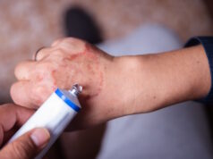 https://www.vecteezy.com/photo/41648212-curing-with-an-allergic-reaction-cream-on-the-hand