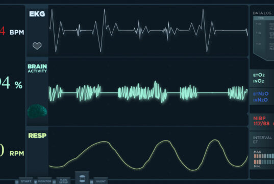 https://www.freepik.com/free-photo/animation-fast-electrocardiogram-reading-display-heartbeats-are-getting-more-intense_20362619.htm#fromView=search&page=1&position=2&uuid=a1f7a6fc-66b0-4bac-8b34-7e608402bc1d&query=cardiogram+