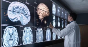 https://www.freepik.com/premium-photo/doctor-analyzing-brain-images-display_173347168.htm#fromView=search&page=1&position=29&uuid=8edf990d-162e-4691-b2de-466fb20b293f&query=brain+scans