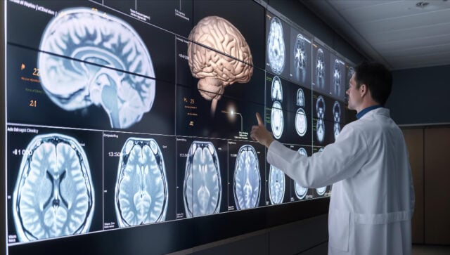 https://www.freepik.com/premium-photo/doctor-analyzing-brain-images-display_173347168.htm#fromView=search&page=1&position=29&uuid=8edf990d-162e-4691-b2de-466fb20b293f&query=brain+scans