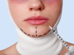 https://www.freepik.com/free-photo/half-face-beautiful-young-caucasian-woman-with-perforation-lines-chin-before-plastic-surgery-operation_8988305.htm#fromView=search&page=1&position=9&uuid=31799531-c364-4610-9d07-08594e8f1f27&query=chin+plastice+surgery