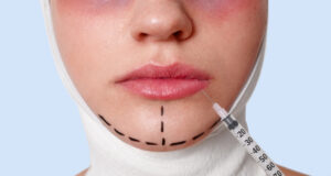 https://www.freepik.com/free-photo/half-face-beautiful-young-caucasian-woman-with-perforation-lines-chin-before-plastic-surgery-operation_8988305.htm#fromView=search&page=1&position=9&uuid=31799531-c364-4610-9d07-08594e8f1f27&query=chin+plastice+surgery