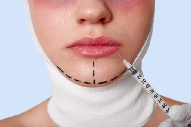 9644 https://www.freepik.com/free-photo/half-face-beautiful-young-caucasian-woman-with-perforation-lines-chin-before-plastic-surgery-operation_8988305.htm#fromView=search&page=1&position=9&uuid=31799531-c364-4610-9d07-08594e8f1f27&query=chin+plastice+surgery