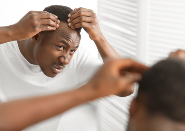 https://www.vecteezy.com/photo/52031493-dandruff-problem-worried-african-american-man-looking-at-flaky-scalp-in-mirror-touching-head-examining-gray-hair-and-hairloss-issue-standing-in-bathroom-at-home-men-s-beauty-and-haircare-treatment