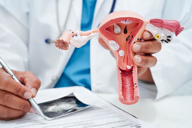 https://www.vecteezy.com/photo/61951496-uterus-asian-woman-holding-human-anatomy-model