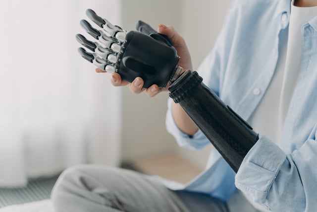 https://www.vecteezy.com/photo/12952348-person-with-disability-puts-together-bionic-prosthetic-arm-ad-of-high-tech-myoelectric-prosthesis
