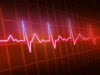 Mayo Clinic Minute: Know The Risk Factors To Prevent Stroke (Video) https://www.magnific.com/premium-photo/red-orange-background-with-heart-beat-it_50999766.htm#fromView=search&page=3&position=30&uuid=98b3480f-0faa-4281-97ec-85b31939515a&query=heart+beat