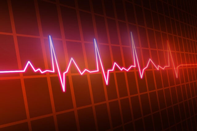 https://www.magnific.com/premium-photo/red-orange-background-with-heart-beat-it_50999766.htm#fromView=search&page=3&position=30&uuid=98b3480f-0faa-4281-97ec-85b31939515a&query=heart+beat