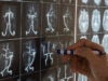 https://www.vecteezy.com/photo/11245739-doctor-demonstarting-brain-mri-anatomy