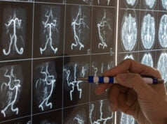 https://www.vecteezy.com/photo/11245739-doctor-demonstarting-brain-mri-anatomy