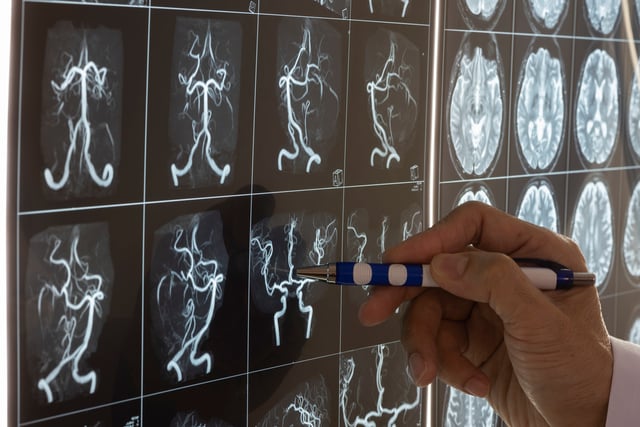 https://www.vecteezy.com/photo/11245739-doctor-demonstarting-brain-mri-anatomy