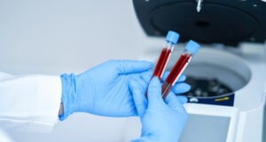 blood machine