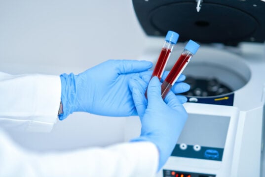 blood machine