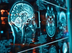 Vitamin C May Help Preserve Brain Gray Matter Volume As We Age https://www.magnific.com/premium-photo/advanced-mri-brain-scan-display-hightech-lab-highresolution-image-displaying-detailed-mri-scan-human-brain-cutting-edge-neurological-research-facility_245725353.htm#from_element=cross_selling__photo