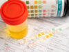 https://www.vecteezy.com/photo/74463812-urinalysis-urine-cup-and-reagent-strip-ph-paper-test-and-comparison-chart-in-laboratory
