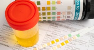 https://www.vecteezy.com/photo/74463812-urinalysis-urine-cup-and-reagent-strip-ph-paper-test-and-comparison-chart-in-laboratory