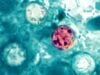 What’s Behind the Rising Cyclospora Outbreaks? Here Is What the FDA Is Investigating