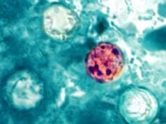 What’s Behind the Rising Cyclospora Outbreaks? Here Is What the FDA Is Investigating