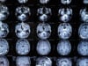 https://www.vecteezy.com/photo/19081031-mri-with-brain-tumor-magnetic-resonance-imaging