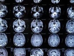 https://www.vecteezy.com/photo/19081031-mri-with-brain-tumor-magnetic-resonance-imaging