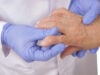 How Early Treatment at Arthritis & Rheumatology Center PC Can Prevent Joint Damage from RA