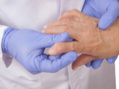 How Early Treatment at Arthritis & Rheumatology Center PC Can Prevent Joint Damage from RA