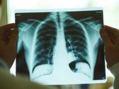 https://www.vecteezy.com/photo/52303131-a-qualified-healthcare-professional-reviews-a-patients-chest-xray-highlighting-the-vital-role-of-diagnostic-imaging-in-patient-care-and-disease-detection-making-it-essential-in-modern-medicine