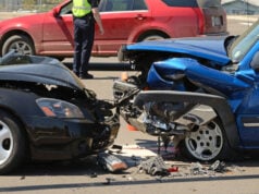 The First 72 Hours: What to Watch for After a Head-On Crash