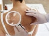https://www.magnific.com/premium-photo/close-up-doctor-holding-magnifying-glass-examining-back-female-patient_88200960.htm#fromView=search&page=1&position=8&uuid=e26c3a7e-5568-4ed8-86f0-24a62b61842e&track=ais_hybrid&query=cancer+skin+lession