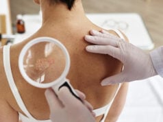 https://www.magnific.com/premium-photo/close-up-doctor-holding-magnifying-glass-examining-back-female-patient_88200960.htm#fromView=search&page=1&position=8&uuid=e26c3a7e-5568-4ed8-86f0-24a62b61842e&track=ais_hybrid&query=cancer+skin+lession