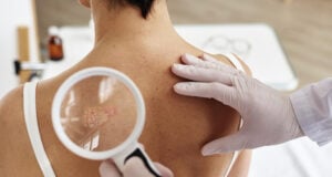 https://www.magnific.com/premium-photo/close-up-doctor-holding-magnifying-glass-examining-back-female-patient_88200960.htm#fromView=search&page=1&position=8&uuid=e26c3a7e-5568-4ed8-86f0-24a62b61842e&track=ais_hybrid&query=cancer+skin+lession
