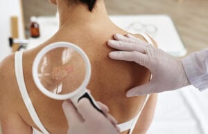 AI Tool May Support Dermatologists In Assessing Skin Lesions For Cancer Risk https://www.magnific.com/premium-photo/close-up-doctor-holding-magnifying-glass-examining-back-female-patient_88200960.htm#fromView=search&page=1&position=8&uuid=e26c3a7e-5568-4ed8-86f0-24a62b61842e&track=ais_hybrid&query=cancer+skin+lession