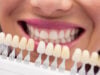 The Growing Role of Dental Crowns and Implants in Oral Health Care https://www.magnific.com/free-photo/dentist-examining-female-patient-with-teeth-shades_8404382.htm#fromView=search&page=1&position=6&uuid=497f2d58-0c6f-4d47-bcf0-147ecb14b65b&track=ais_hybrid&query=dental+crowns