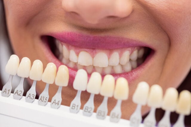 65412 https://www.magnific.com/free-photo/dentist-examining-female-patient-with-teeth-shades_8404382.htm#fromView=search&page=1&position=6&uuid=497f2d58-0c6f-4d47-bcf0-147ecb14b65b&track=ais_hybrid&query=dental+crowns