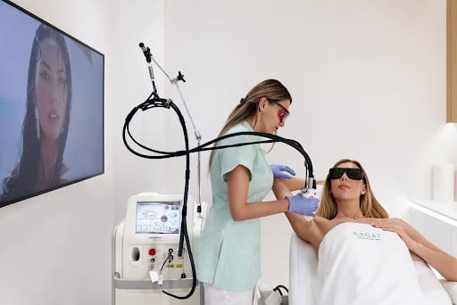 laser hair removal