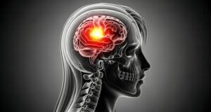 https://www.vecteezy.com/photo/71455469-brain-inflammation-anatomy-scan-x-ray-headache-migraine-brain-tumor-or-neurological-disorder-concept