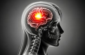 https://www.vecteezy.com/photo/71455469-brain-inflammation-anatomy-scan-x-ray-headache-migraine-brain-tumor-or-neurological-disorder-concept
