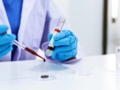 Multicancer Blood Test Detects 17 Cancer Types In Large Prospective Study https://www.vecteezy.com/photo/1223477-scientist-is-testing-blood-sample