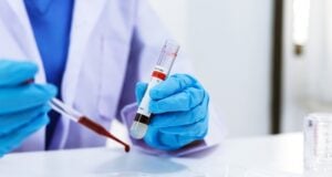 https://www.vecteezy.com/photo/1223477-scientist-is-testing-blood-sample