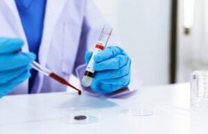 https://www.vecteezy.com/photo/1223477-scientist-is-testing-blood-sample